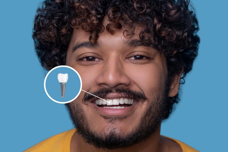 young-man-with-toothy-smile-demonstrating-his-dental-implant_259150-57670